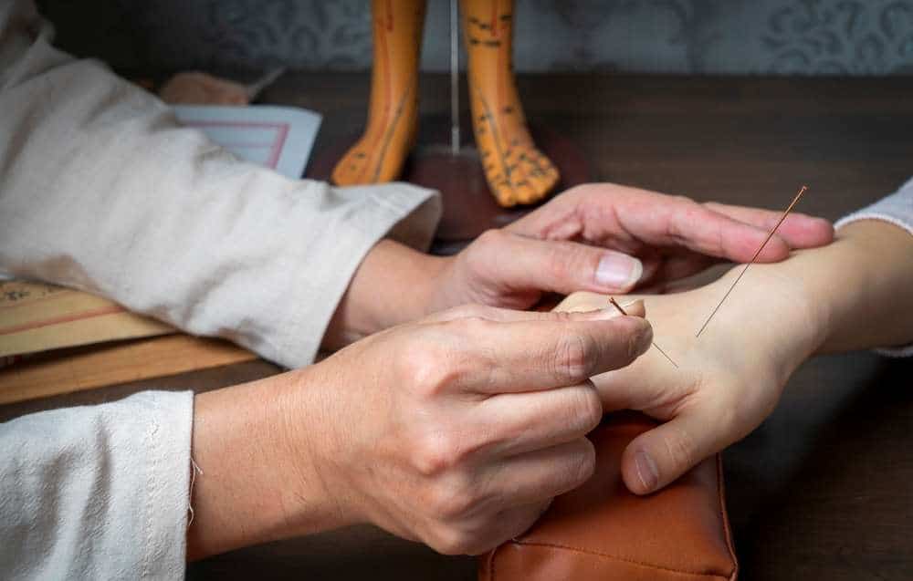 ประโยชน์ของการฝังเข็มคือการดูแลสุขภาพแบบองค์รวม
